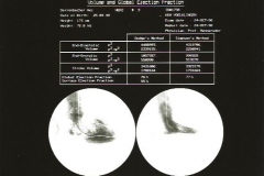 digitale Angiografie des LV ca. 1985